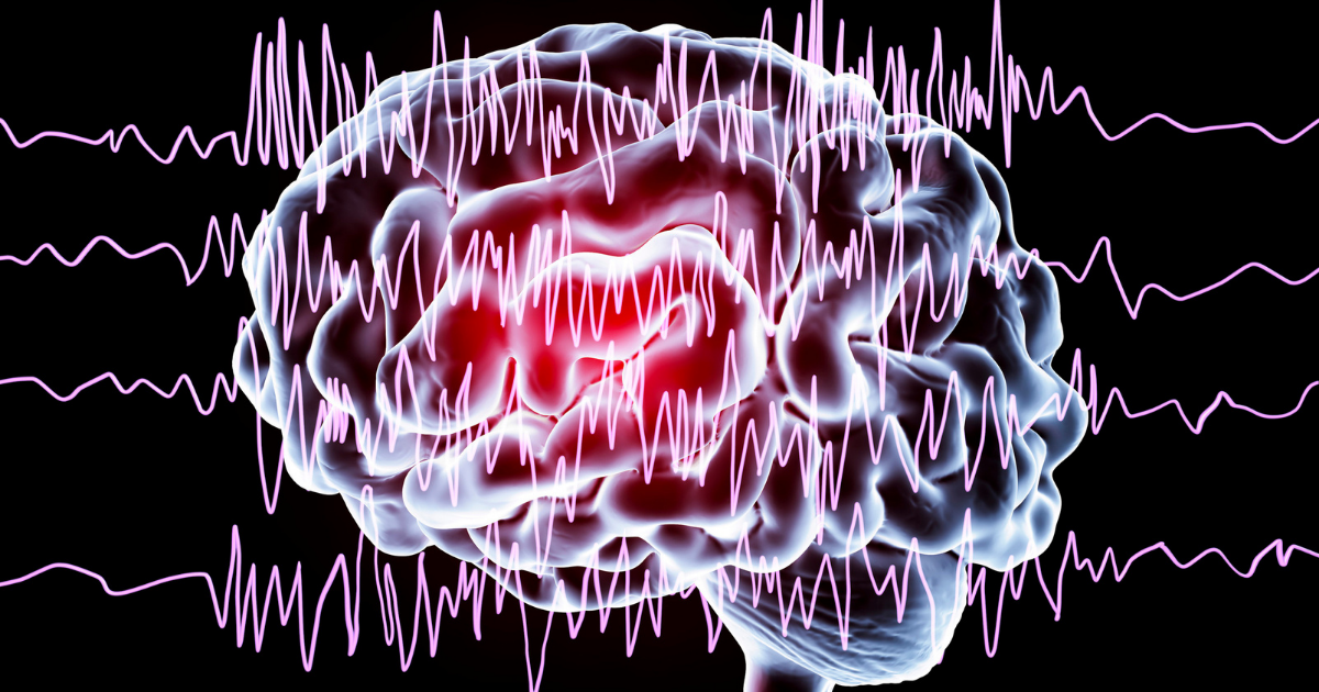 Epilepsi Nedir