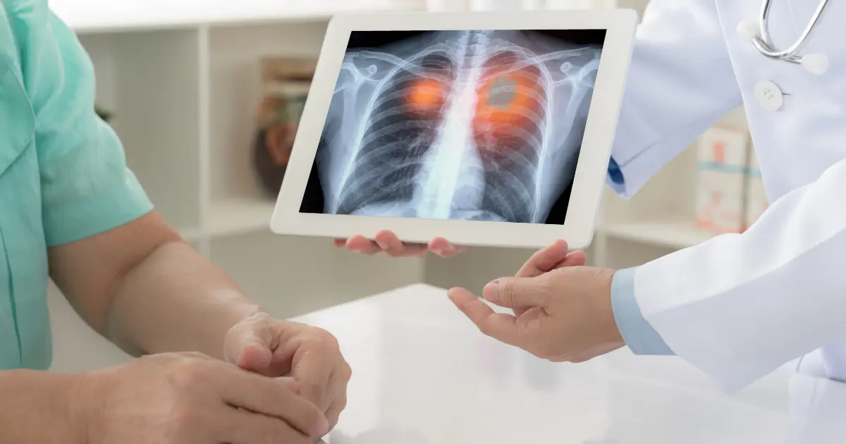 Akciğer Kanserinin Tanı ve Tedavi Yöntemleri Nelerdir