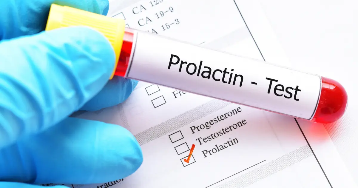 prolaktin nedir prolaktin ne işe yarar